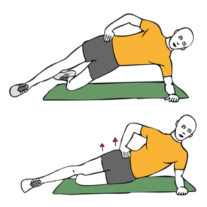 Bursitis Trocanterea