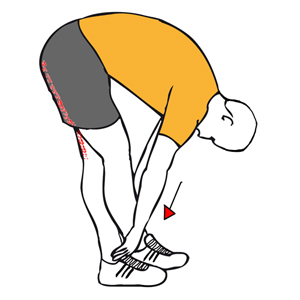 Bursitis Trocanterea