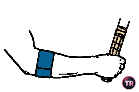 Cincha para antebrazo