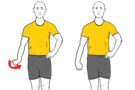 Movilización del nervio radial