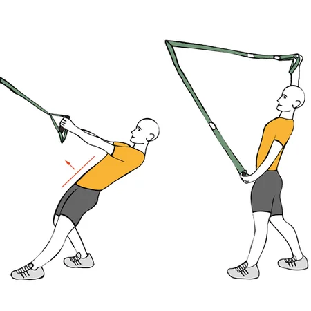 Aperturas inversas con trx