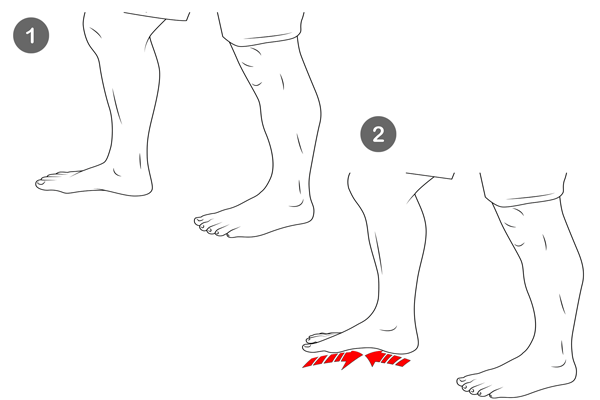 Ejercicio esguince de tobillo.