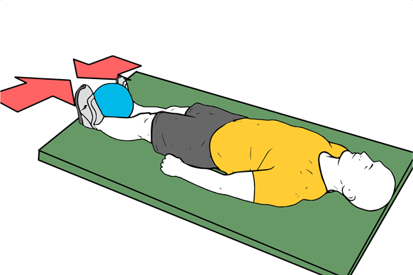 Pubalgia o osteopatía de pubis. Semana 1 y 2