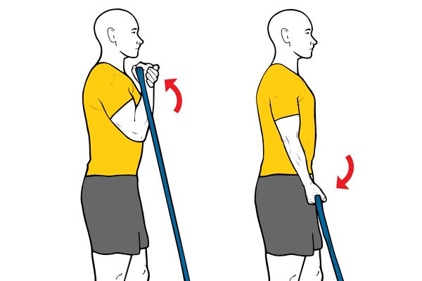 Tendinopatia del biceps.