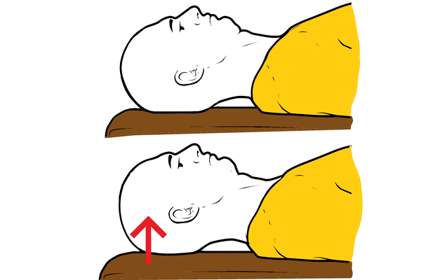 Elevación craneal: flexores cervicales profundos