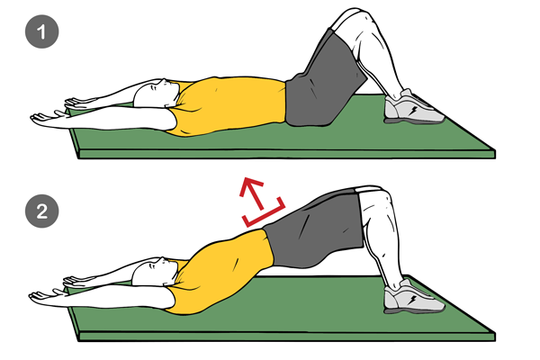 Hernia lumbar: Fortalecimiento del core