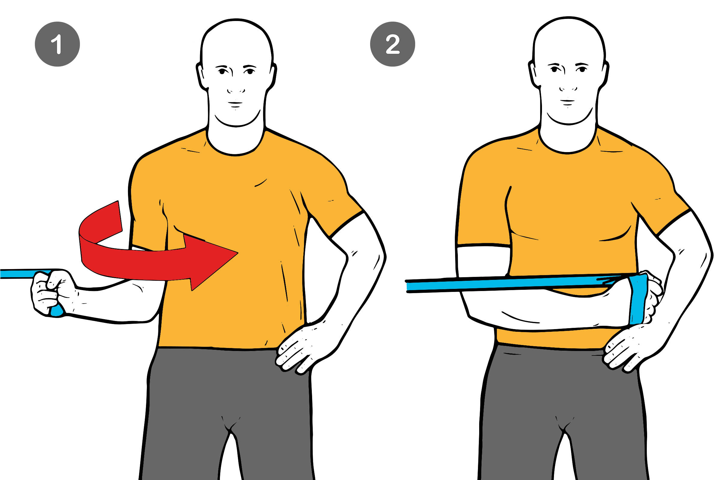 SLAP: Lesión del tendón bicipital