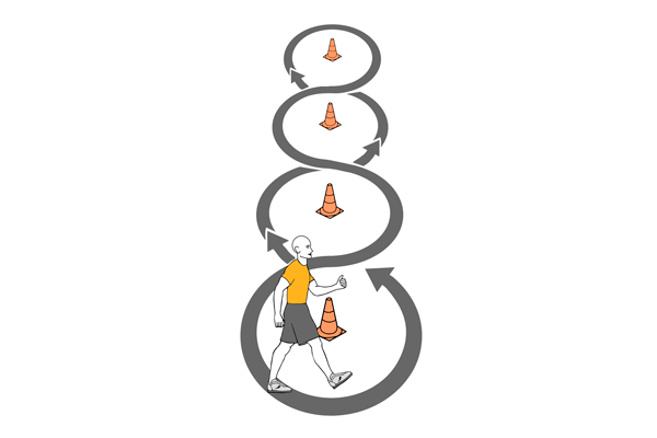 Artrosis de cadera-AP